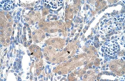 Anti-SLA/LP antibody, N-term used in IHC (Paraffin sections) (IHC-P). GTX47200