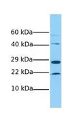 Anti-RBM24 antibody, Internal used in Western Blot (WB). GTX47201