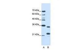 Anti-ALKBH8 antibody, N-term used in Western Blot (WB). GTX47220
