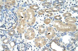 Anti-RAVER1 antibody, N-term used in IHC (Paraffin sections) (IHC-P). GTX47224