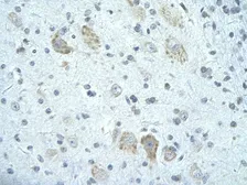 Anti-FIP1L1 antibody, C-term used in IHC (Paraffin sections) (IHC-P). GTX47245