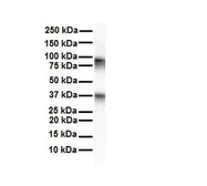 Anti-CPEB4 antibody, N-term used in Western Blot (WB). GTX47246