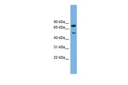 Anti-RBM42 antibody, Internal used in Western Blot (WB). GTX47254