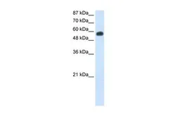 Anti-NOC4L antibody, C-term used in Western Blot (WB). GTX47257