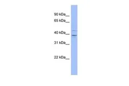 Anti-MTHFSD antibody, N-term used in Western Blot (WB). GTX47260