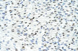Anti-MATR3 antibody, N-term used in IHC (Paraffin sections) (IHC-P). GTX47279