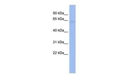 Anti-CDKN2AIP antibody, N-term used in Western Blot (WB). GTX47293