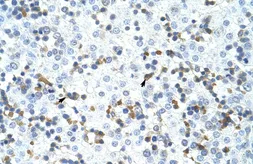 Anti-CPSF73 antibody, C-term used in IHC (Paraffin sections) (IHC-P). GTX47302