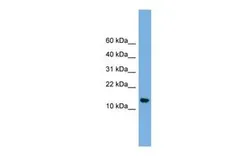 Anti-LSM8 antibody, N-term used in Western Blot (WB). GTX47304