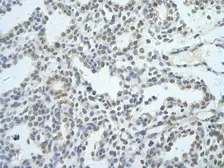 Anti-NIP7 antibody, Internal used in IHC (Paraffin sections) (IHC-P). GTX47306