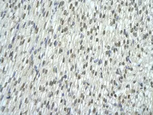 Anti-EXOSC7 antibody, N-term used in IHC (Paraffin sections) (IHC-P). GTX47313