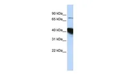 Anti-KIAA0427 antibody, N-term used in Western Blot (WB). GTX47315