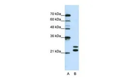 Anti-CSDC2 antibody, N-term used in Western Blot (WB). GTX47321