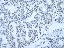 Anti-HNRPH3 antibody, N-term used in IHC (Paraffin sections) (IHC-P). GTX47329
