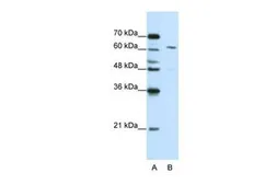 Anti-CPSF6 antibody, Internal used in Western Blot (WB). GTX47333
