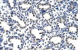 Anti-POP4 antibody, C-term used in IHC (Paraffin sections) (IHC-P). GTX47339