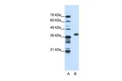 Anti-PCBP1 antibody, Internal used in Western Blot (WB). GTX47350