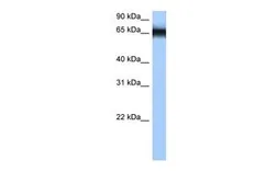 Anti-hnRNP M antibody, N-term used in Western Blot (WB). GTX47353