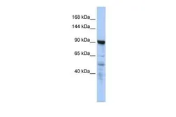 Anti-CTAGE5 antibody, N-term used in Western Blot (WB). GTX47354