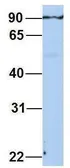 Anti-SF3A1 antibody, N-term used in Western Blot (WB). GTX47356