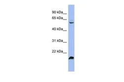 Anti-SFRS4 antibody, Internal used in Western Blot (WB). GTX47361