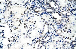 Anti-Nucleolin antibody, C-term used in IHC (Paraffin sections) (IHC-P). GTX47363