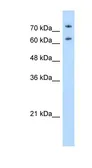Anti-Nucleolin antibody, N-term used in Western Blot (WB). GTX47364