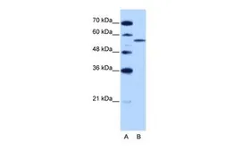 Anti-ZRSR2 antibody, C-term used in Western Blot (WB). GTX47366