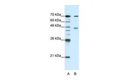Anti-PABPC4 antibody, N-term used in Western Blot (WB). GTX47371