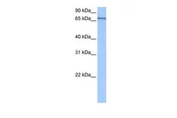 Anti-PABPC4 antibody, Internal used in Western Blot (WB). GTX47372