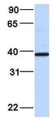 Anti-EIF3G antibody, Internal used in Western Blot (WB). GTX47377