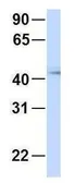 Anti-RTCD1 antibody, N-term used in Western Blot (WB). GTX47378