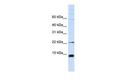 Anti-SNRPF antibody, Internal used in Western Blot (WB). GTX47382