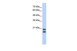 Anti-Serglycin antibody, Internal used in Western Blot (WB). GTX47391