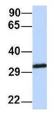 Anti-Gemin2 antibody, Internal used in Western Blot (WB). GTX47412