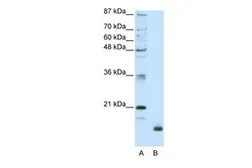 Anti-RPL32 antibody, N-term used in Western Blot (WB). GTX47428