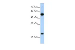 Anti-RPL13 antibody, C-term used in Western Blot (WB). GTX47429