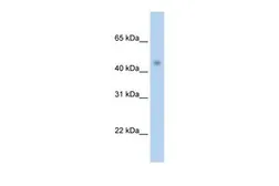 Anti-PRMT8 antibody, C-term used in Western Blot (WB). GTX47431