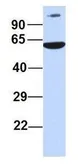 Anti-PRMT7 antibody, N-term used in Western Blot (WB). GTX47432