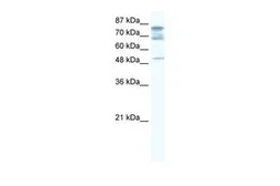 Anti-DDX46 antibody, C-term used in Western Blot (WB). GTX47439