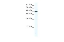 Anti-G3BP1 antibody used in Western Blot (WB). GTX47441