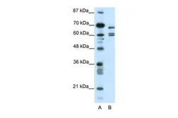 Anti-KCNK5 antibody, C-term used in Western Blot (WB). GTX47446