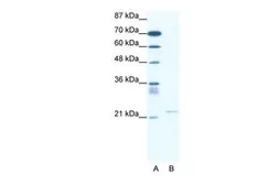 Anti-TRPM3 antibody, N-term used in Western Blot (WB). GTX47453
