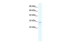 Anti-TRPM3 antibody, N-term used in Western Blot (WB). GTX47454