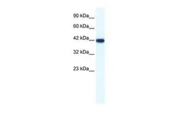 Anti-Bone Sialoprotein antibody, N-term used in Western Blot (WB). GTX47466