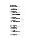 Anti-MCM9 antibody, N-term used in Western Blot (WB). GTX47470