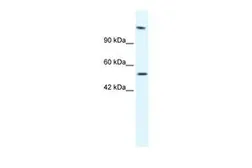 Anti-HELB antibody, N-term used in Western Blot (WB). GTX47497