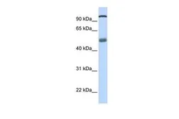 Anti-DHX32 antibody, N-term used in Western Blot (WB). GTX47507