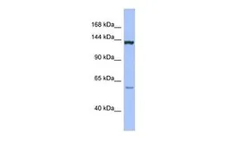 Anti-DHX34 antibody, Internal used in Western Blot (WB). GTX47515