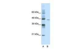 Anti-DDX25 antibody, C-term used in Western Blot (WB). GTX47517